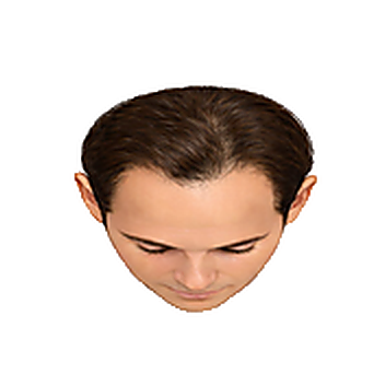 Stage 2