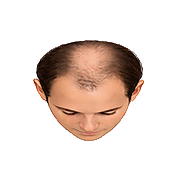 Stage 5