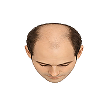 Stage 6