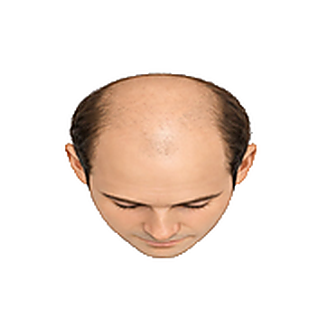 Stage 7