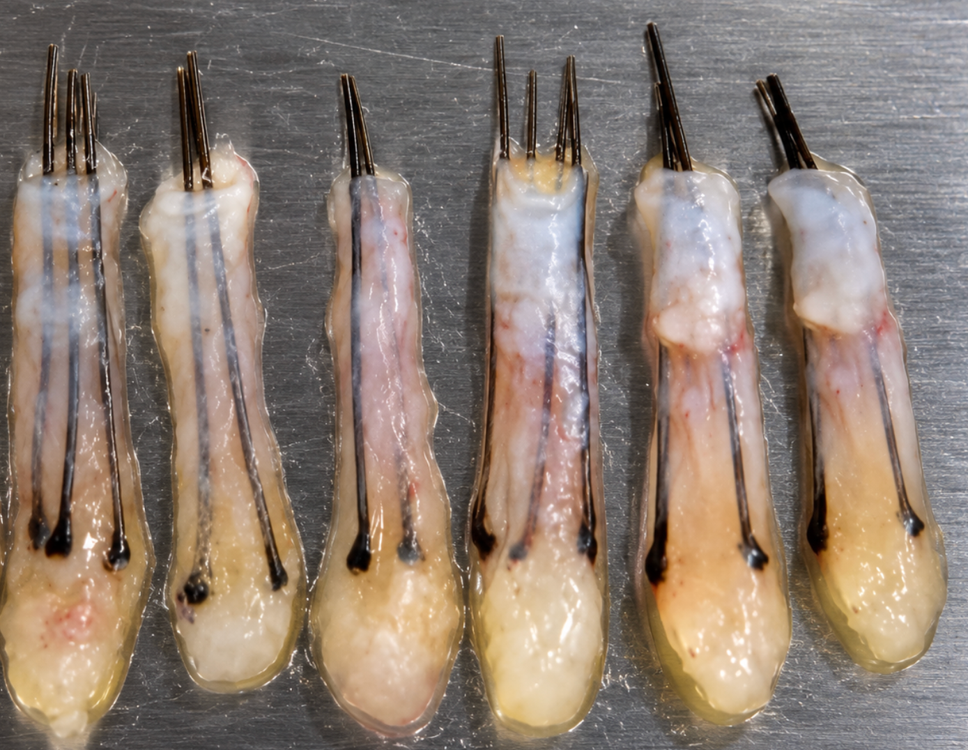 poor hair graft handling